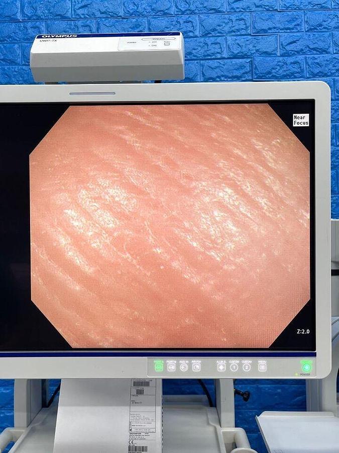 Used OLYMPUS CV-290 CLV-290 Complete Towers with 290 HD Gastro and 290 HD Long colonoscope Endoscopy Processor