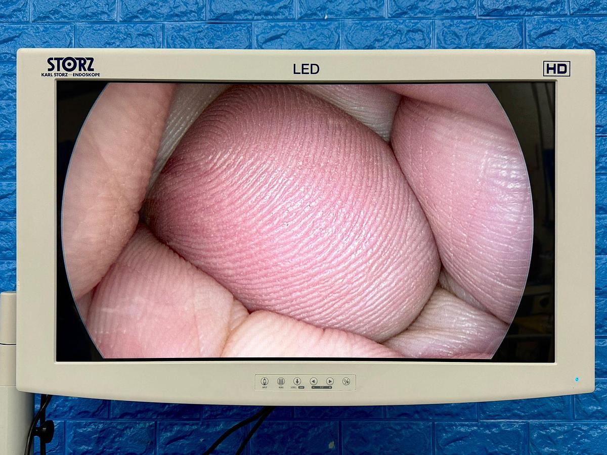 Used Stryker 4 mm 30° Ideal Eyes HD Autoclavable Arthroscope Optic REF: 0502-104-030