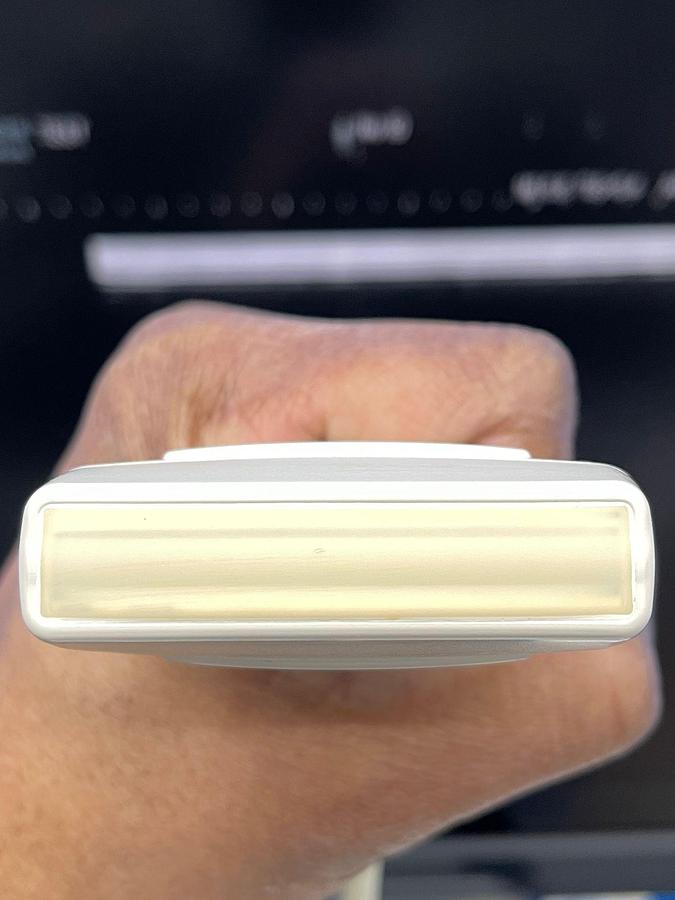 Used Hitachi Aloka Arietta V70 Ultrasound  YOM: 2016 With 5x Probes