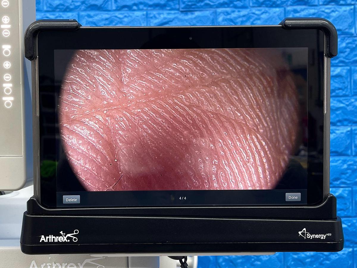 Used Arthrex Synergy HD3 Tower