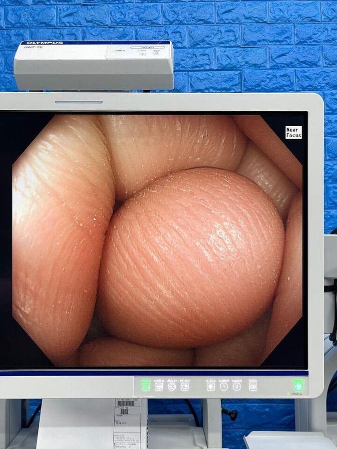 Used OLYMPUS CV-290 CLV-290 Complete Towers with 290 HD Gastro and 290 HD Long colonoscope Endoscopy Processor