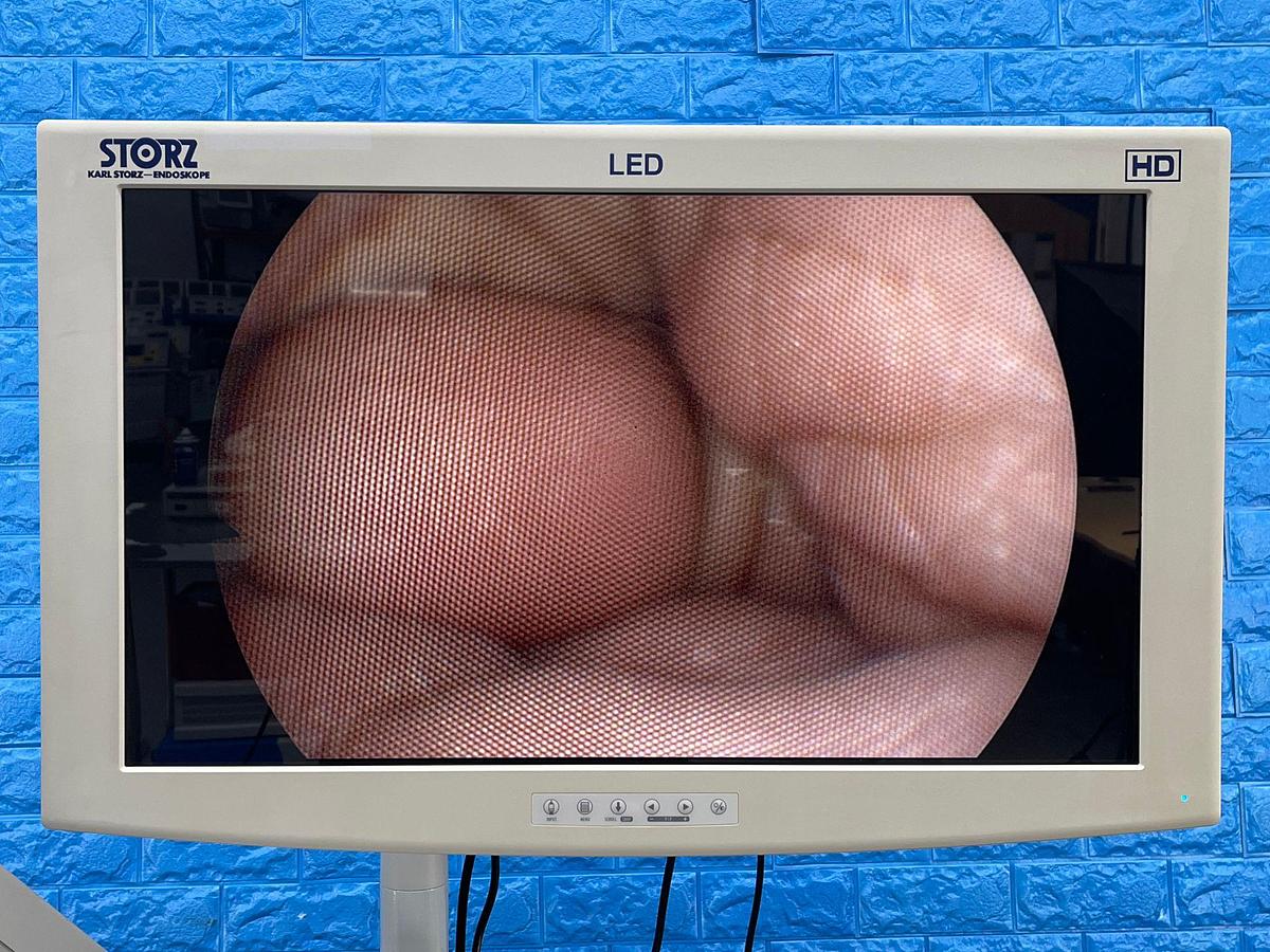 Used Karl Storz 11004 BC1 Broncho Fiberscope