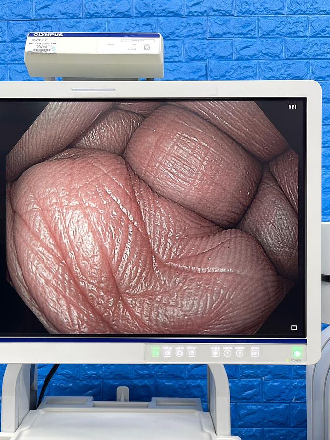 Used Olympus CV-190 with CLV-190 Endoscopy Tower 