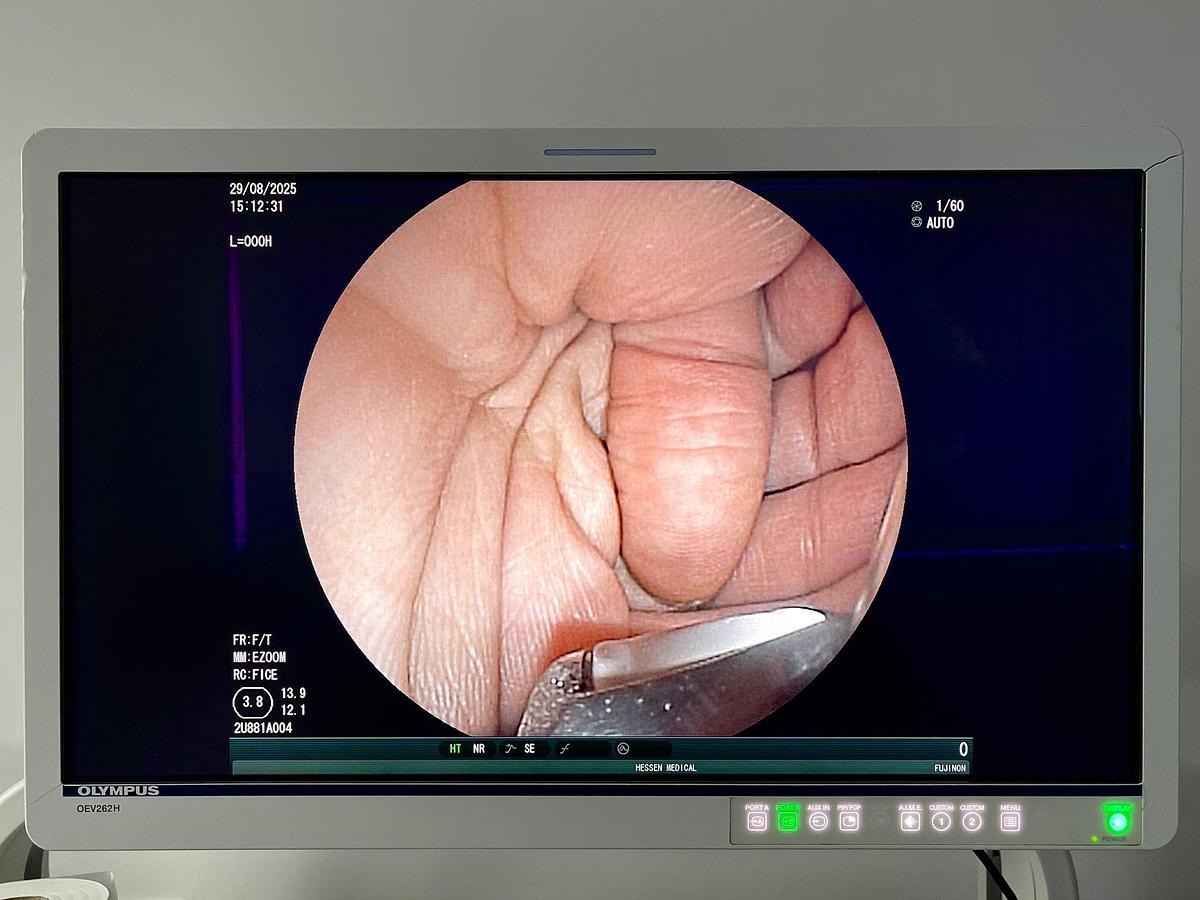 Used Fujinon Scope Model: EG-530UT YOM: 2008 