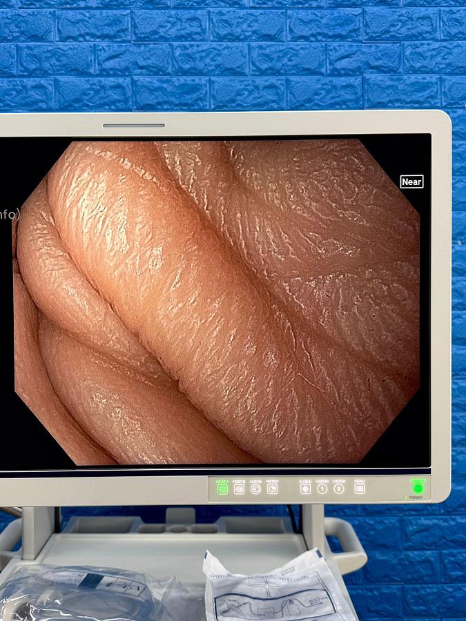 OLYMPUS-Evis-X1-CV-1500-Endoscopy-Tower 