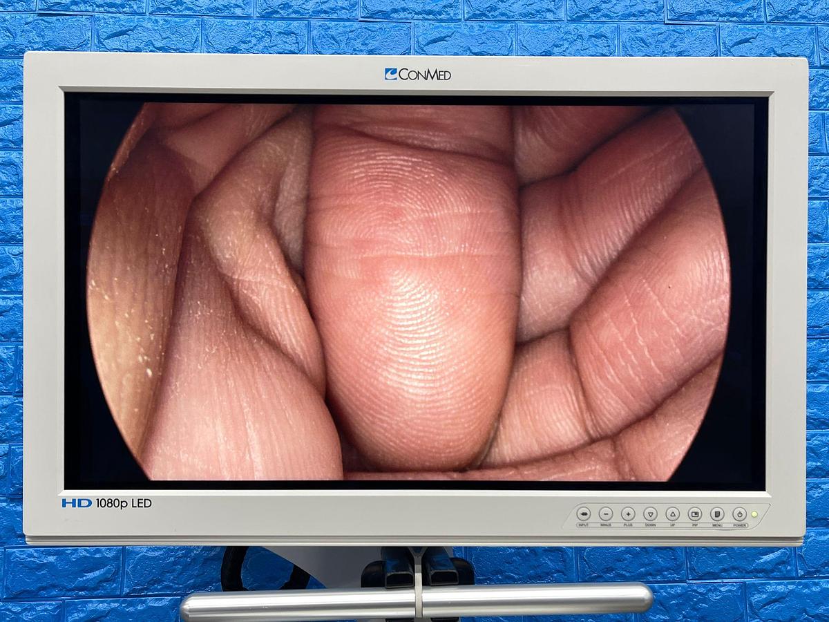 Used ConMed  Laparoscopy Tower