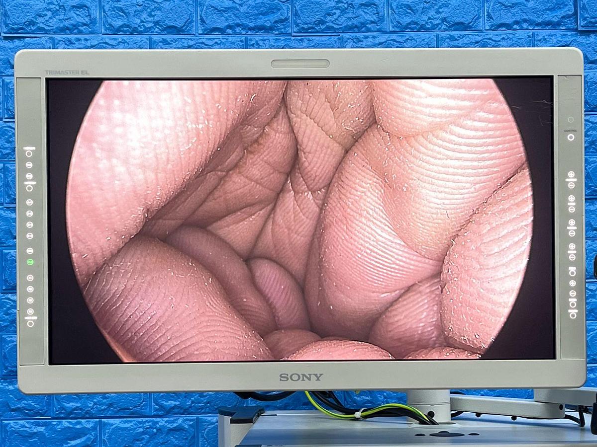 Used Arthrex Synergy HD3 Tower