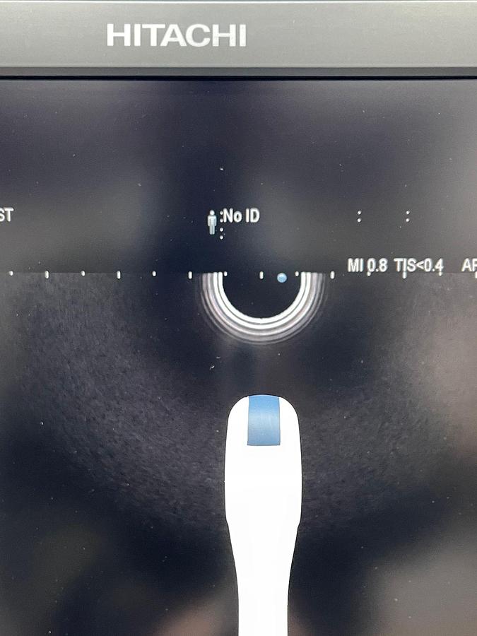 Used Hitachi Aloka Arietta V70 Ultrasound  YOM: 2016 With 5x Probes