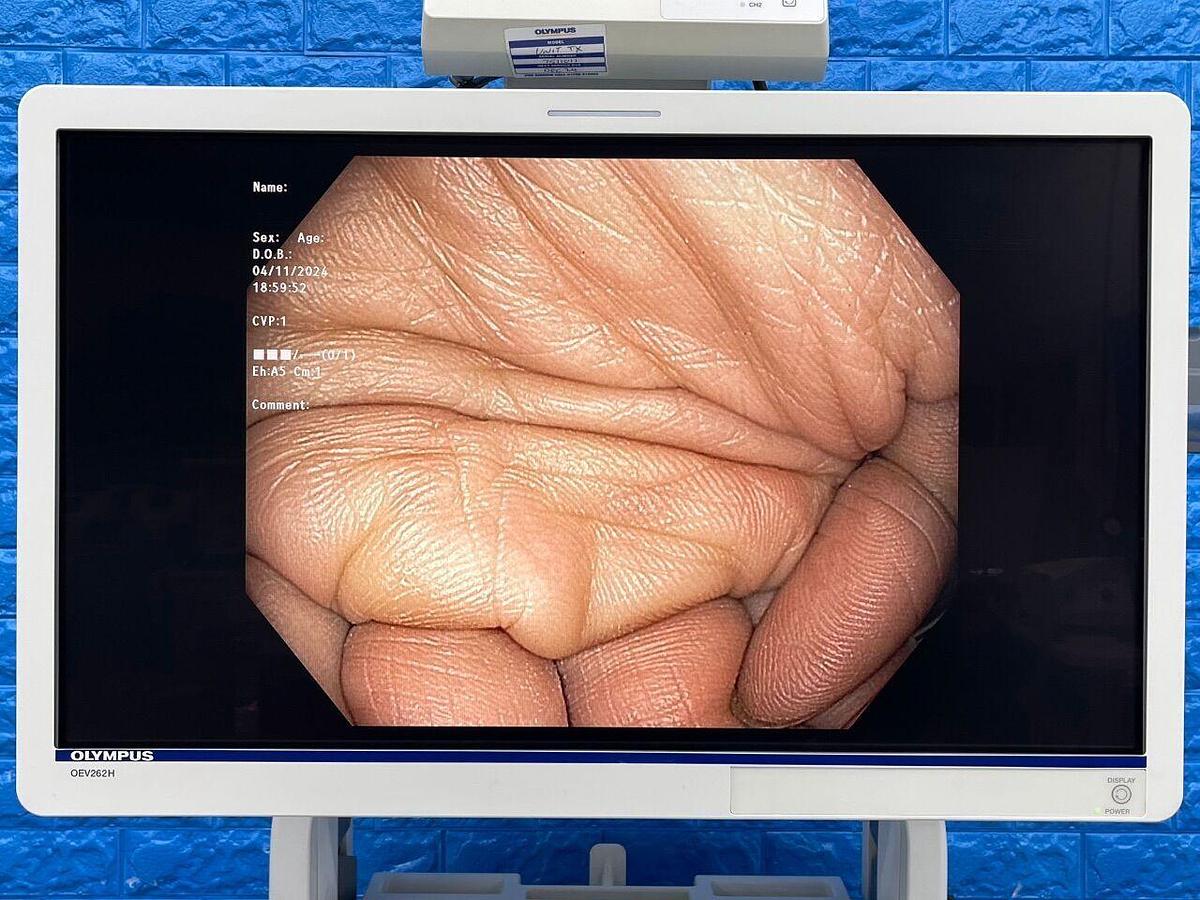 Used OLYMPUS CV-190/CLV-190 Tower Endoscope