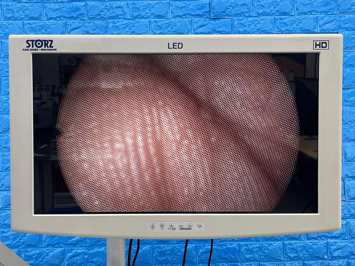 Used Karl Storz 11004 BC1 Broncho Fiberscope