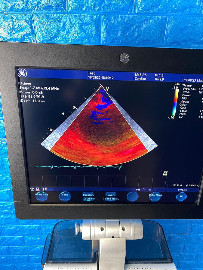 Used GE VIVID S6 YOM: 2013 Includes: M4S Cardiac Probe