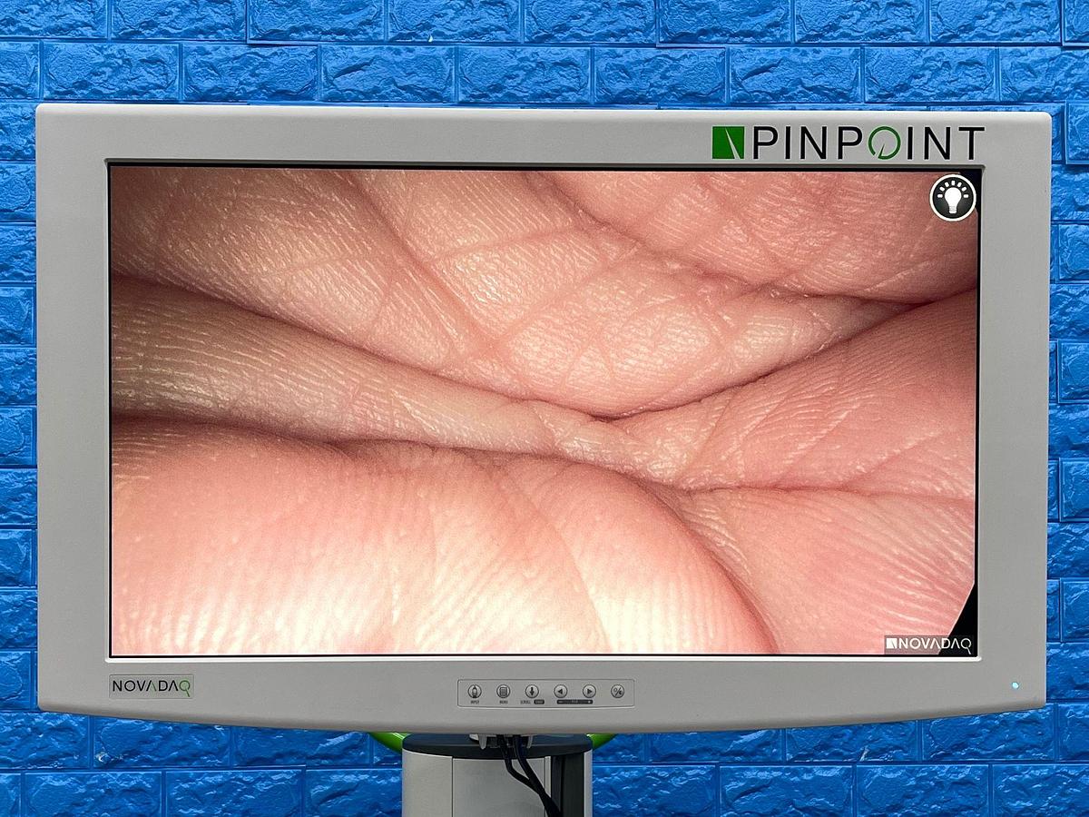 Used Pinpoint Laparoscopy Tower YOM: 2018