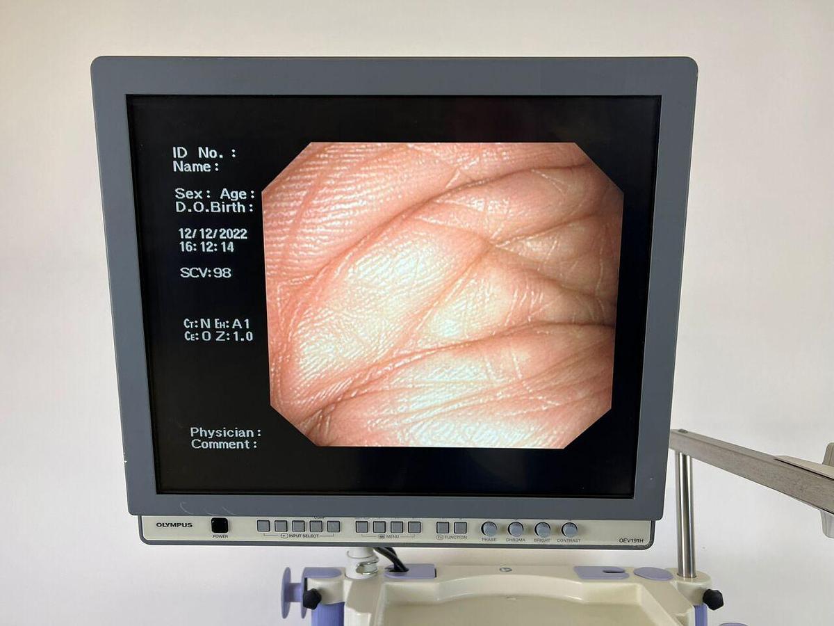 Used OLYMPUS CV-260SL complete Tower with GIF-H260 Gastro and CF-Q260DL Long Colonoscope Endoscope