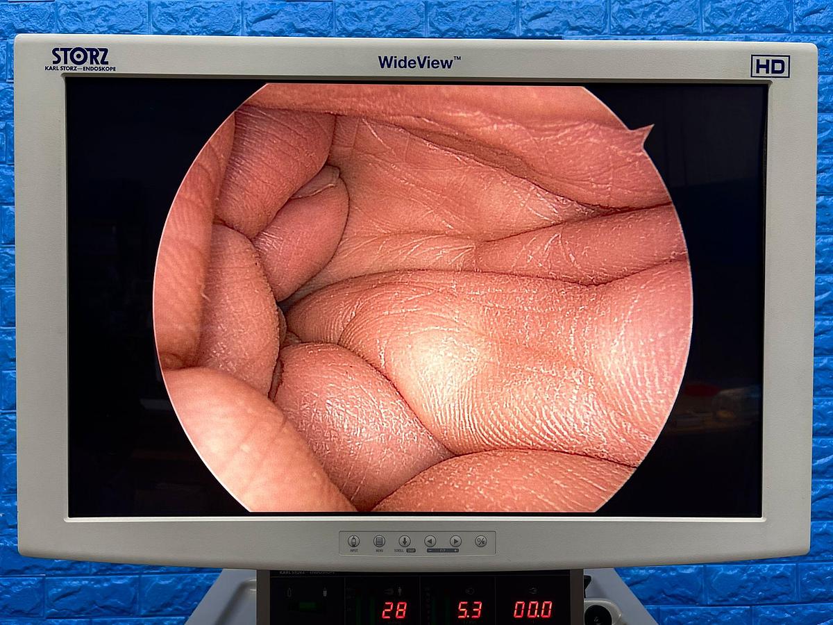 Used Karl Storz Laparoscopy Tower Karl Storz 24Inch LCD Monitor  Karl Storz Endoflator  Karl Storz Xenon 300 Karl Storz Image 1 Hub Karl Storz H3 Camera Head