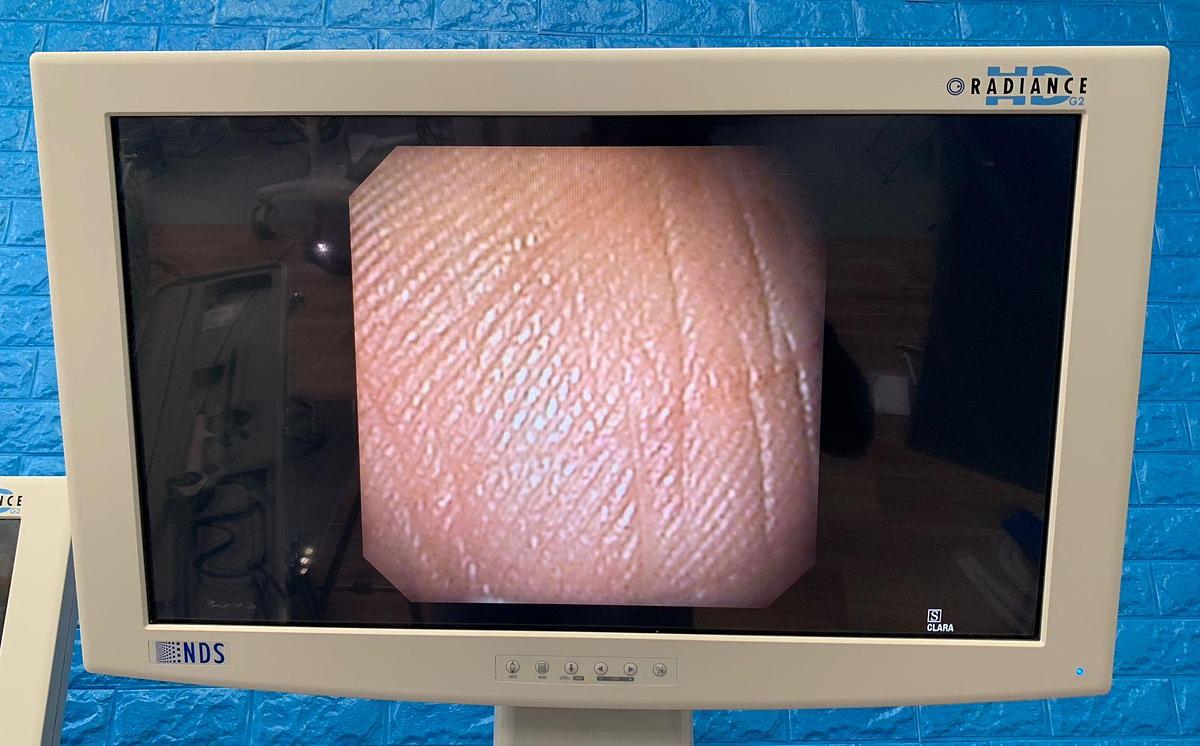 Used KARL STORZ 11292 VS 