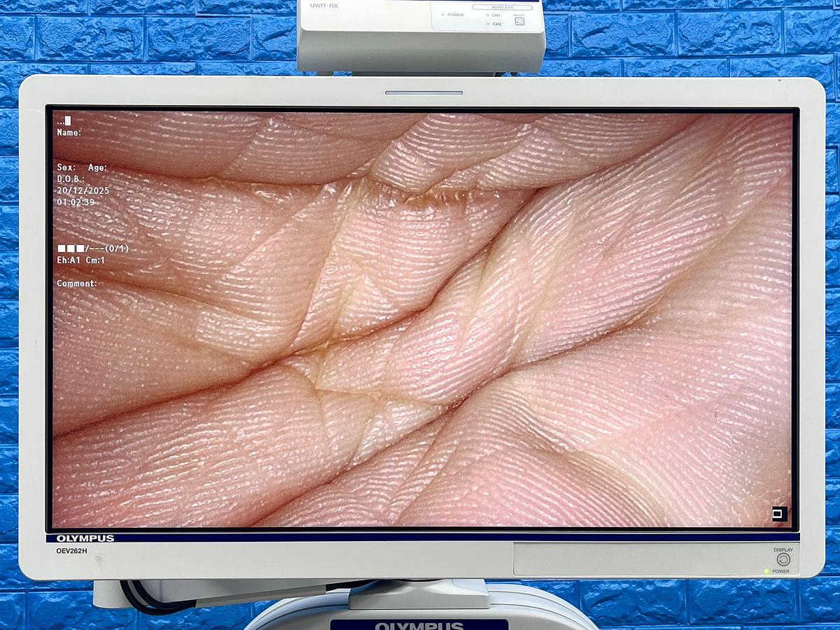 Used Olympus Camera Head Model: CH-S190-XZ-E 