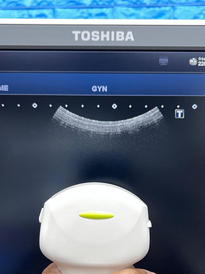 Used Toshiba Ultrasound Aplio 500 YOM: 2015