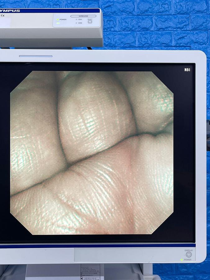 Used Olympus TJF-260V Duedenoscope