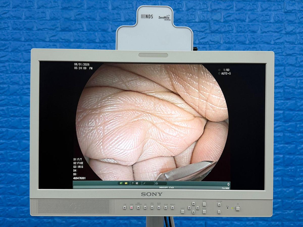 Used Fujinon Scope EG-580 UT Linear Ultrasonic Endoscope YOM: 2018 