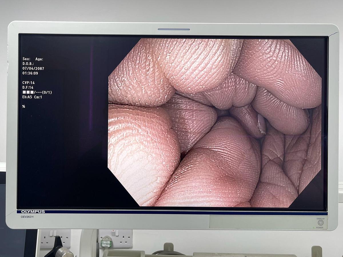 Used Olympus Scope Model: PCF-H180AL