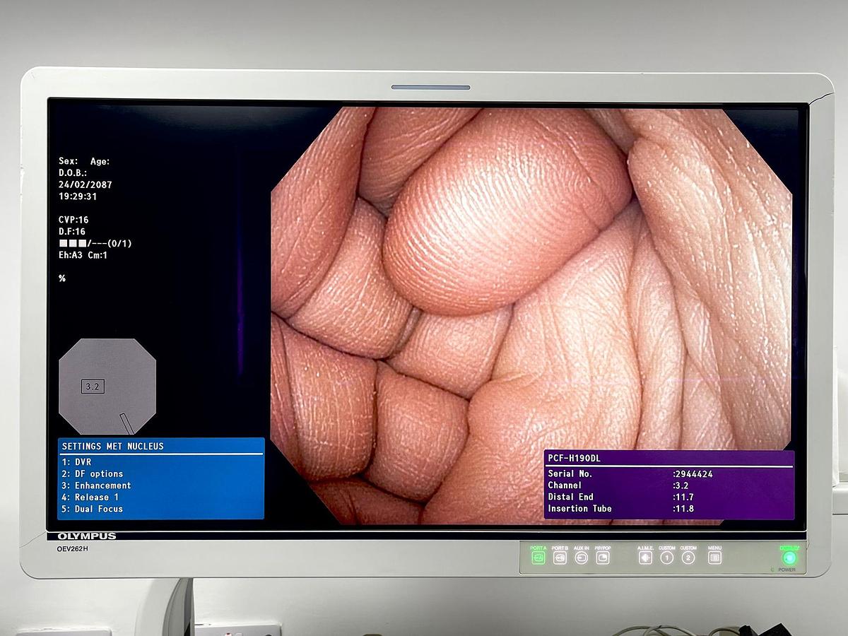 Used Olympus PCF-H190DL Colonoscope