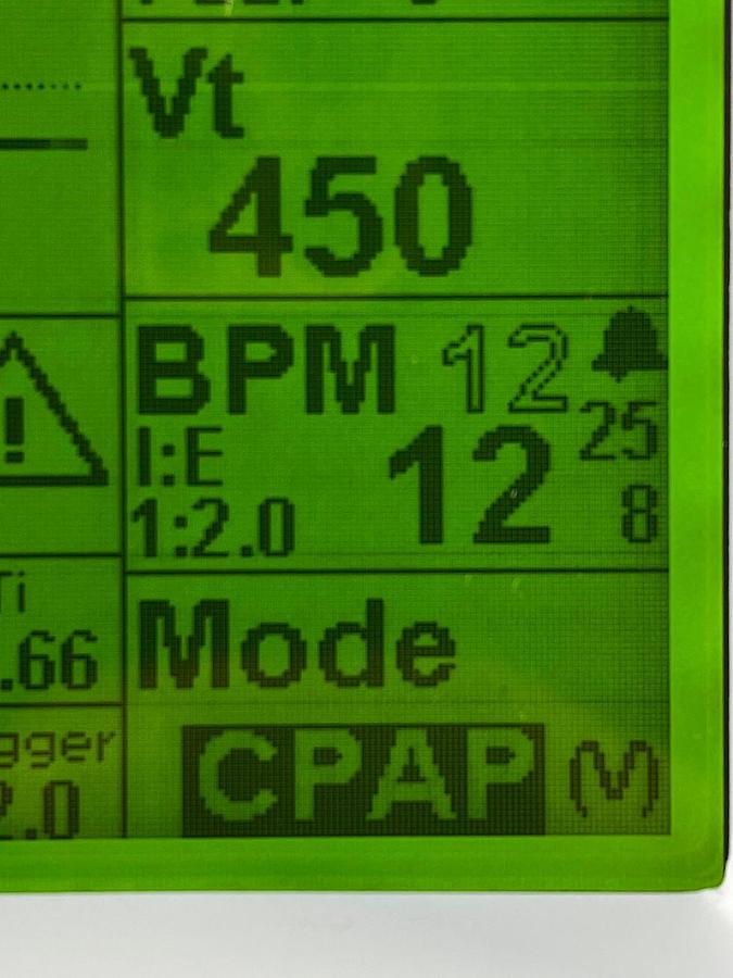 Used Zoll 731 Series Ventilator YOM: 2019 -4 pieces