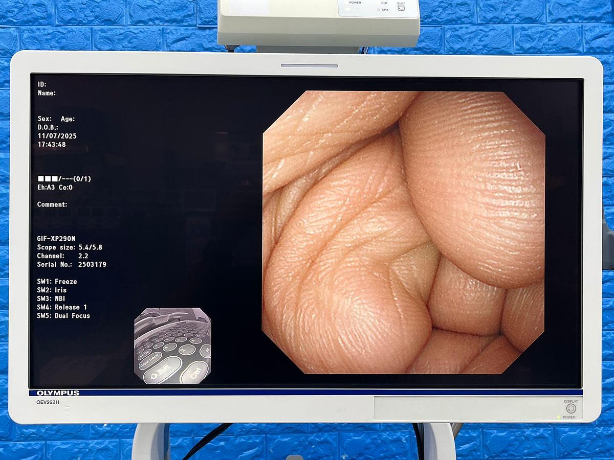 Used Olympus GIF-XP290N Gastroscope