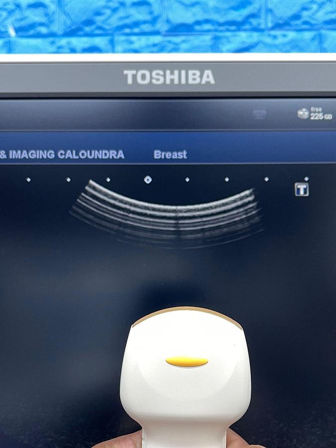 Used TOSHIBA Ultrasound Aplio 500 YOM: 2015 