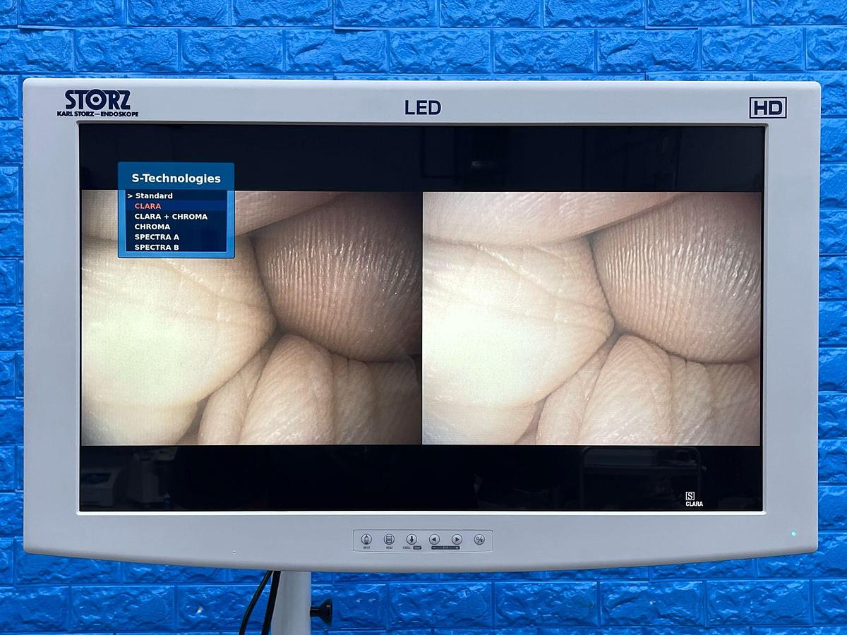 Used Karl Storz Scope Model: 13821 PKS