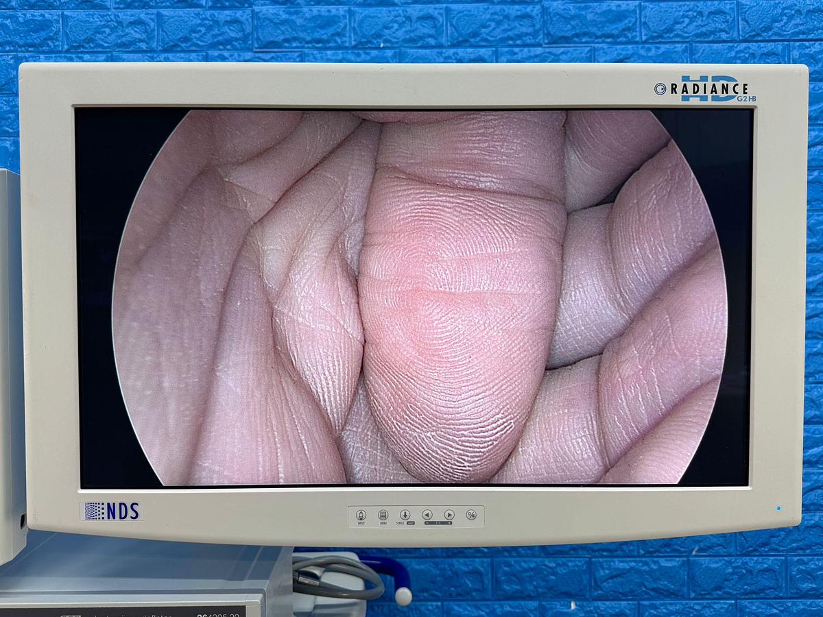 Used Karl Storz Spies Tower: -LCD Monitor 26 Inch  -Aida Monitor 19 Inch Touch Screen -Endoflator with Hose  -Keyboard -Camera Head H3-Z Spies S Full HD TH100  -Aida Control WD 200 -Xenon 300 Light source  -Spies S TC200/TC300 -Sony Printer