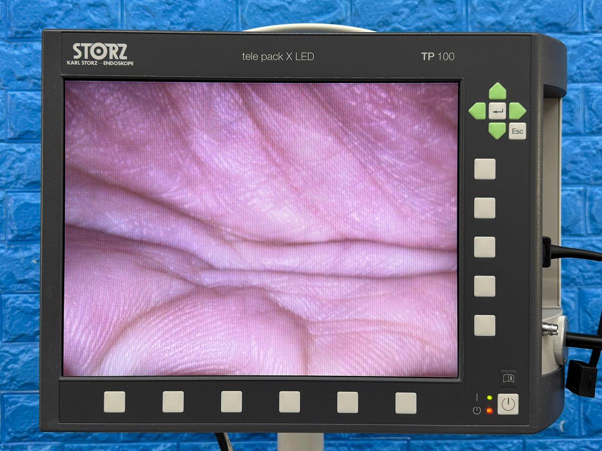 Used Karl Storz Tele Pack X LED TP 100  