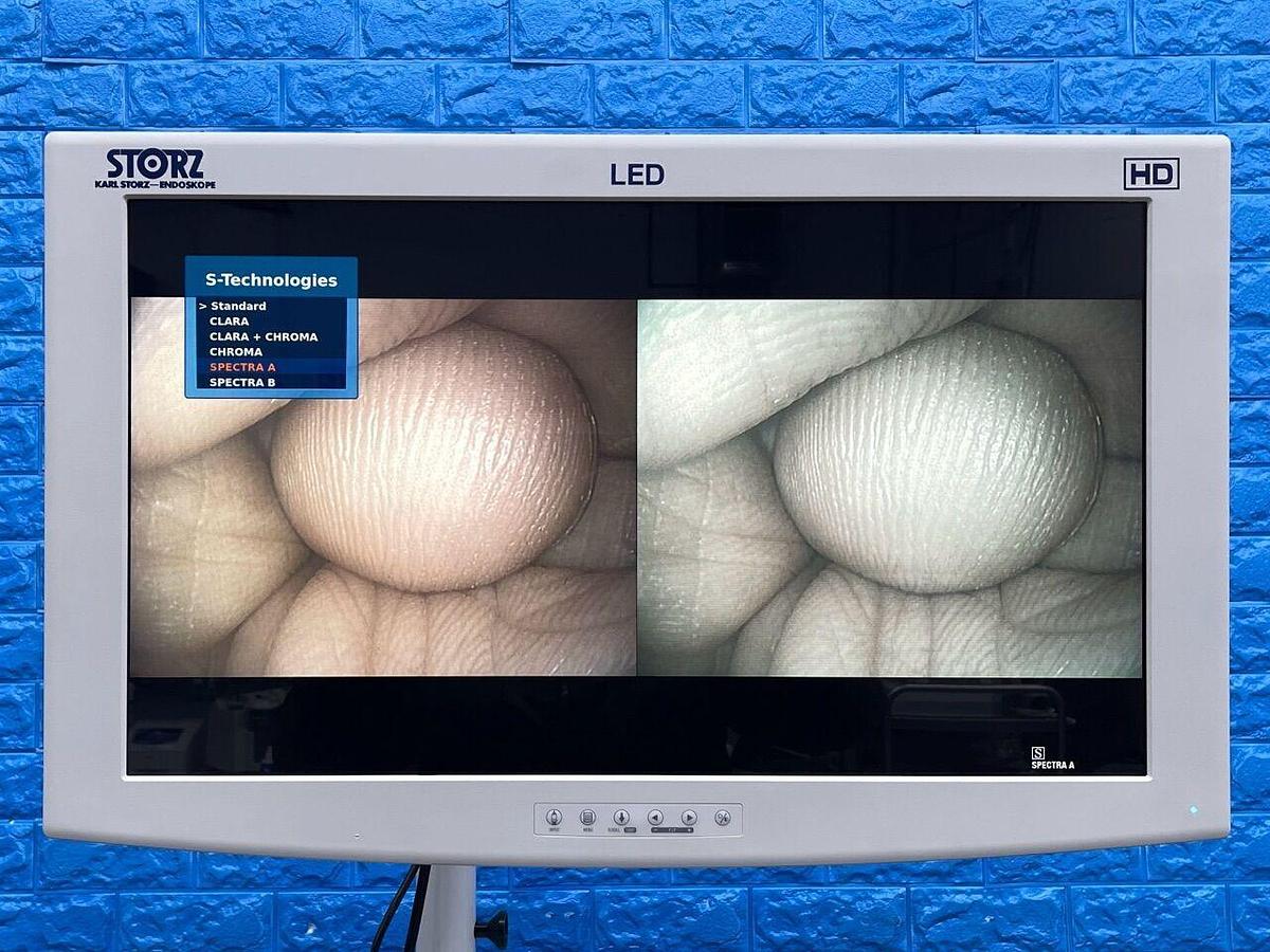 Used KARL STORZ Scope Model