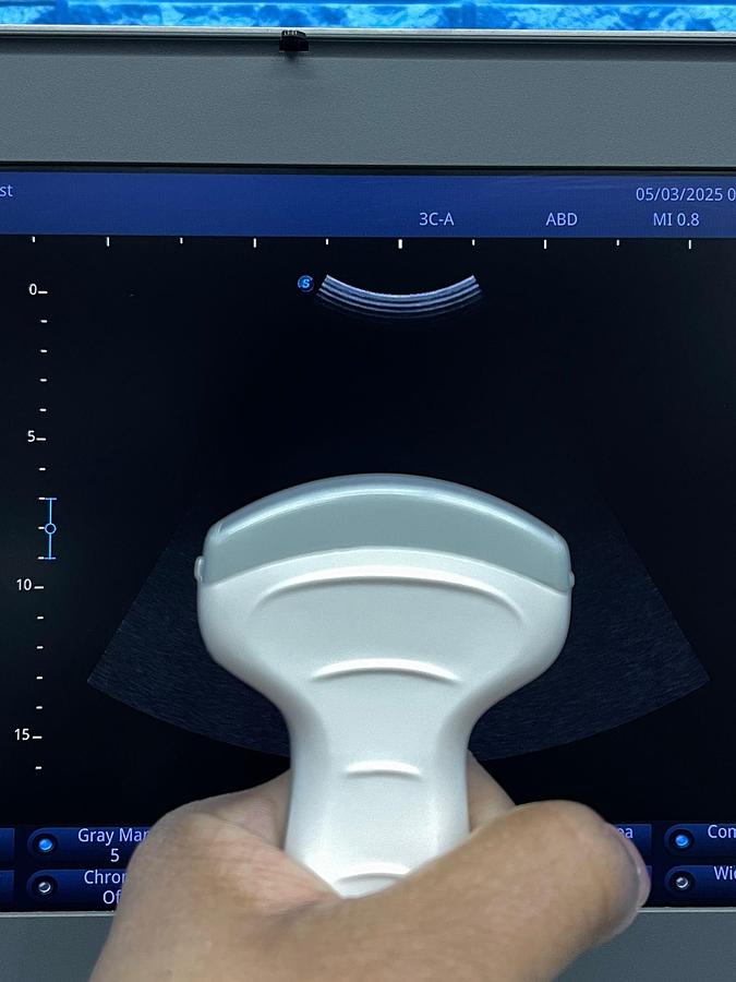 Used Sonoscape X3 Ultrasound YOM: 2019