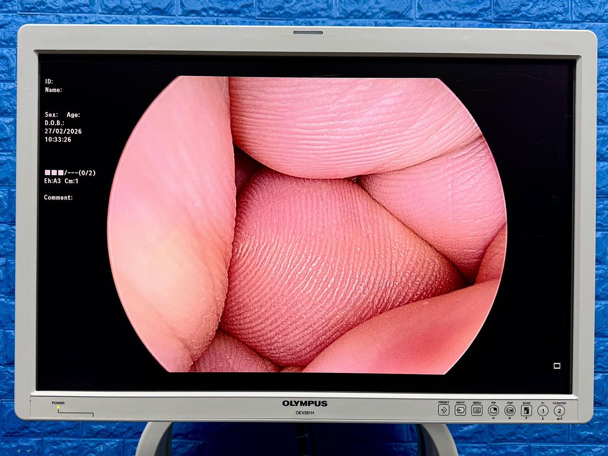 Used Olympus OTV-S190 Tower Processor OTV-S190  SN: 7354579 Light Source CLV-S190 SN: 7304202 Olympus OEV261H Monitor  YOM: 2013 SN: 7354100 Olympus UHI-4  YOM: 2021 SN: 7159219 Olympus IMH-20 SN: 7331770 Olympus Camera Head CH-S190-XZ-E SN: 7506197 Olympus MAJ-1921 Keyboard  Sony Digital Colour Printer