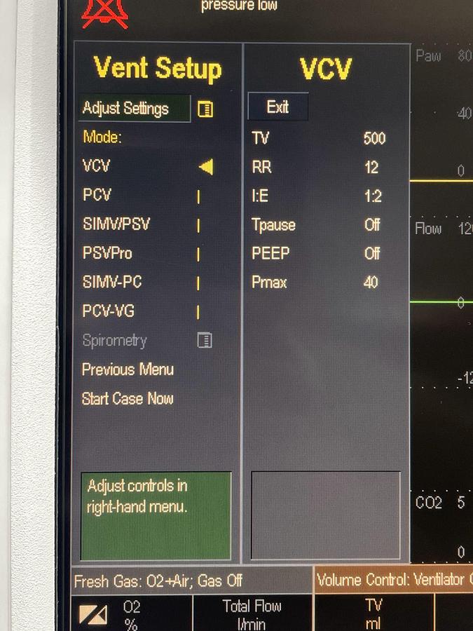 Used GE Datex-Ohmeda S/5 Anesthesia  YOM: 2008