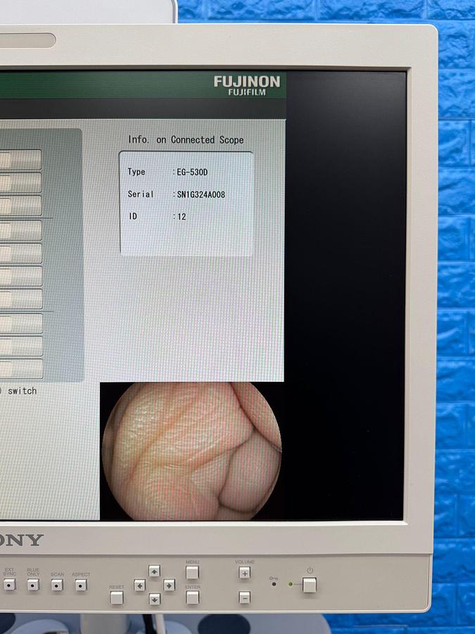 Used Fujinon Scope  Model: EG-530D 