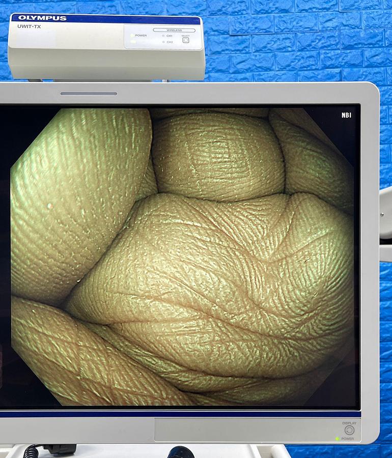 Used Olympus CF-HQ290L Colonoscope