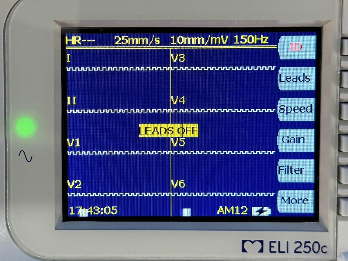 Used Mortara ELI 250c Electrocardiograph ECG REF: EL I250c-BCB-BAFAX 