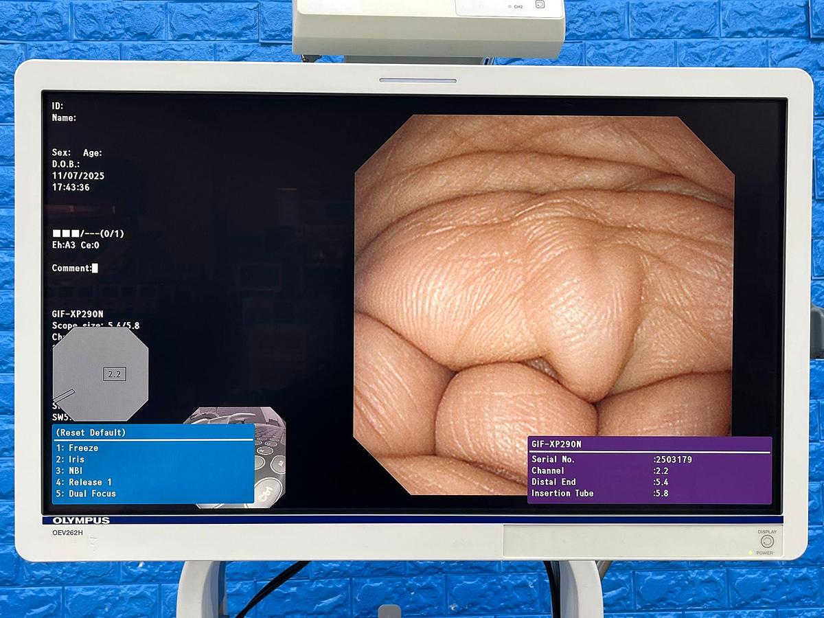 Used Olympus GIF-XP290N Gastroscope