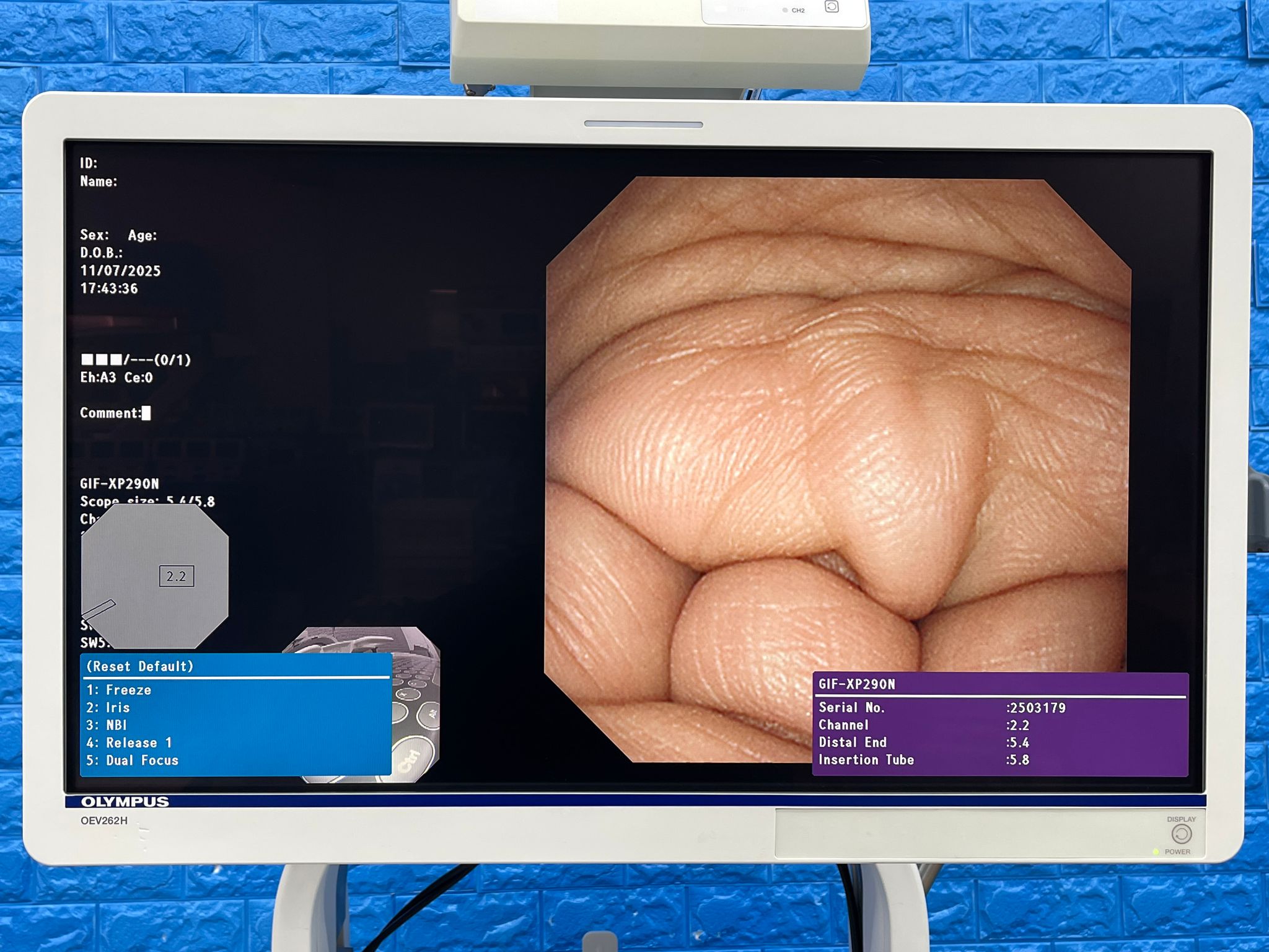 Used Olympus GIF-XP290N Gastroscope