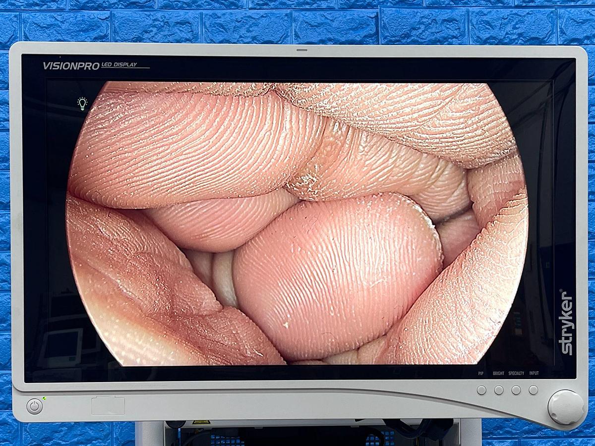 Used Stryker 1588 Tower, LCD Monitor, YOM: 2017