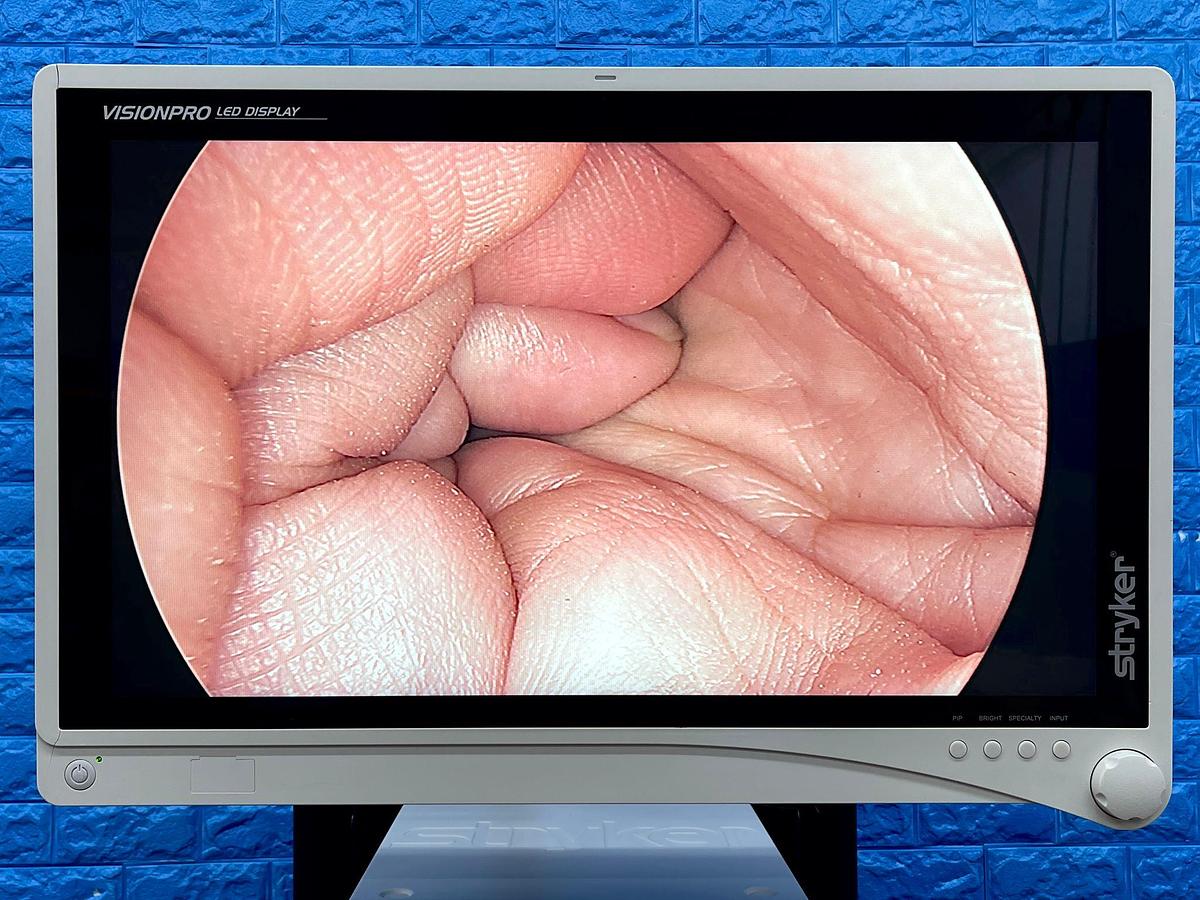 Used Stryker 1488 Camera Head REF: 1488-210-105 -6 Pieces