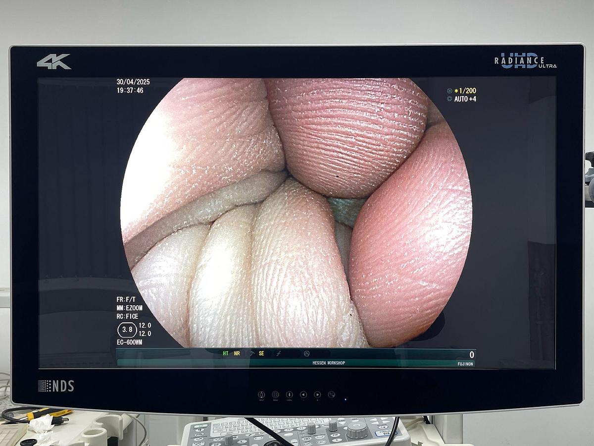 Used FUJINON Scope Model: EC-600WM Colonoscope