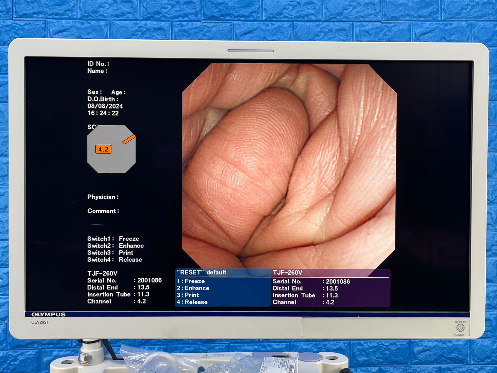 Used Olympus TJF 260V Duodenoscope