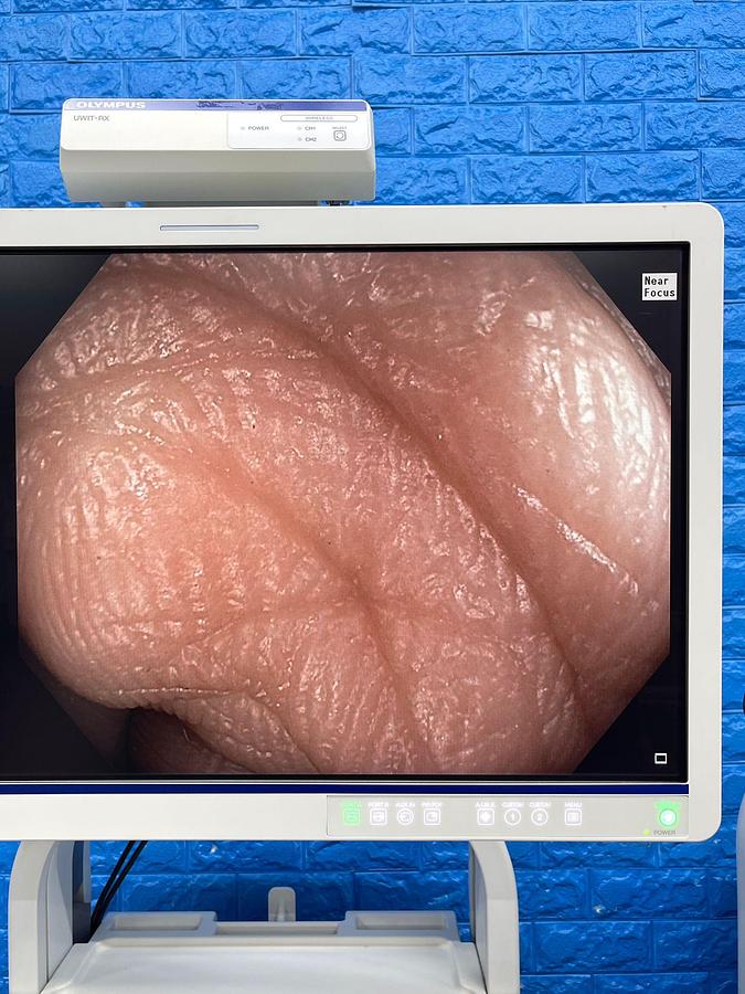 Used Olympus CV-190 with CLV-190 Endoscopy Tower 