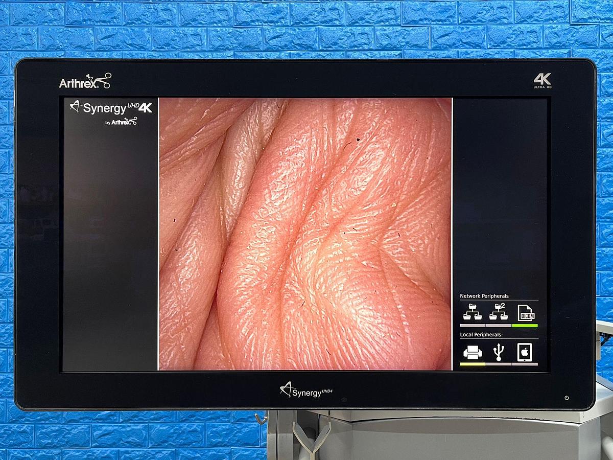 Used ARTHREX Synergy UHD4 4K Tower LED 4K Monitor 32 inch YOM: 2018