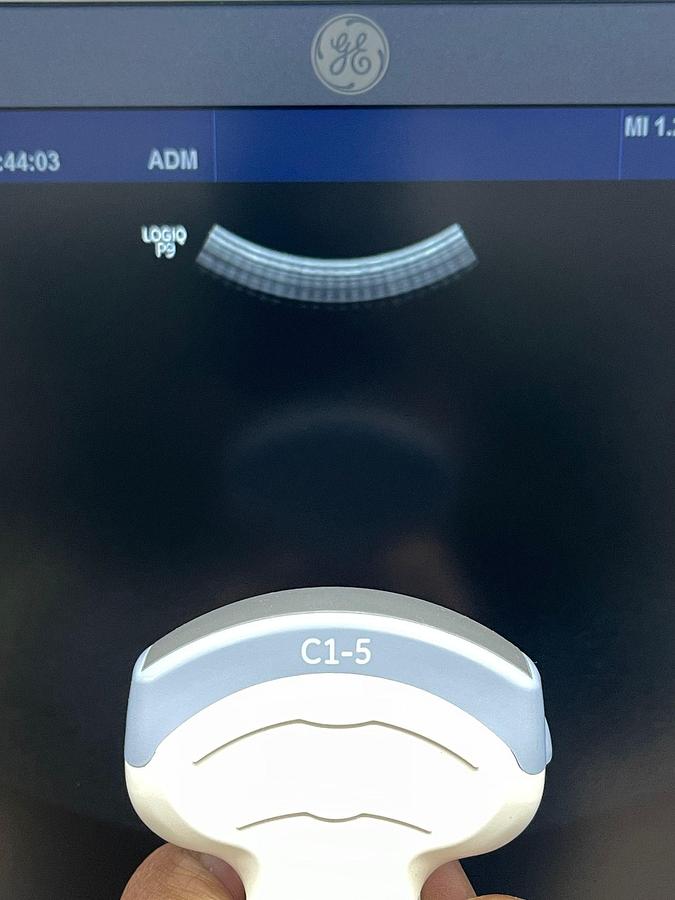 Used GE Logiq P9 Ultrasound YOM: 2016 With 2 Probes