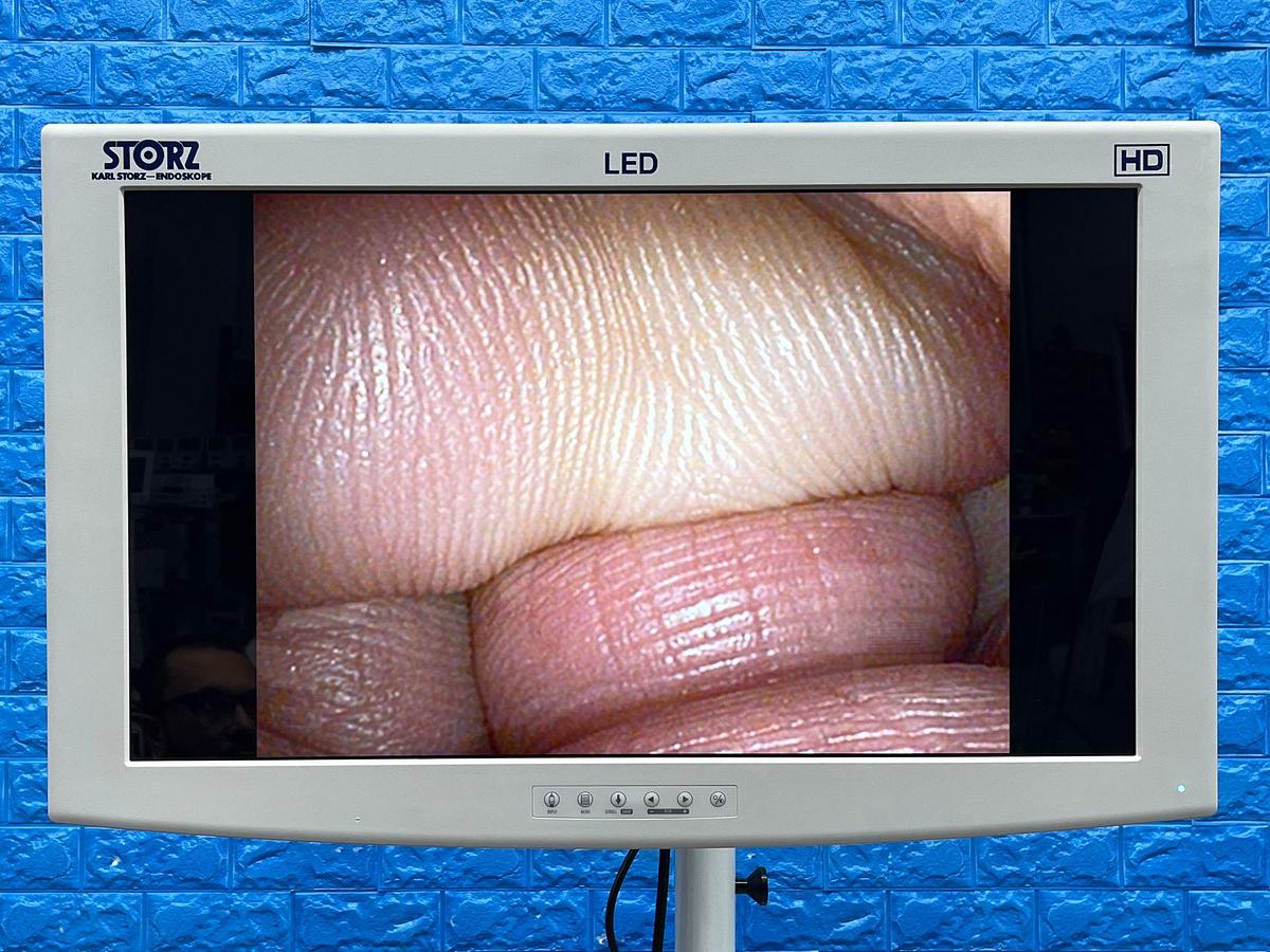 Used Karl Storz 11272 VN Cystoscope Scope.