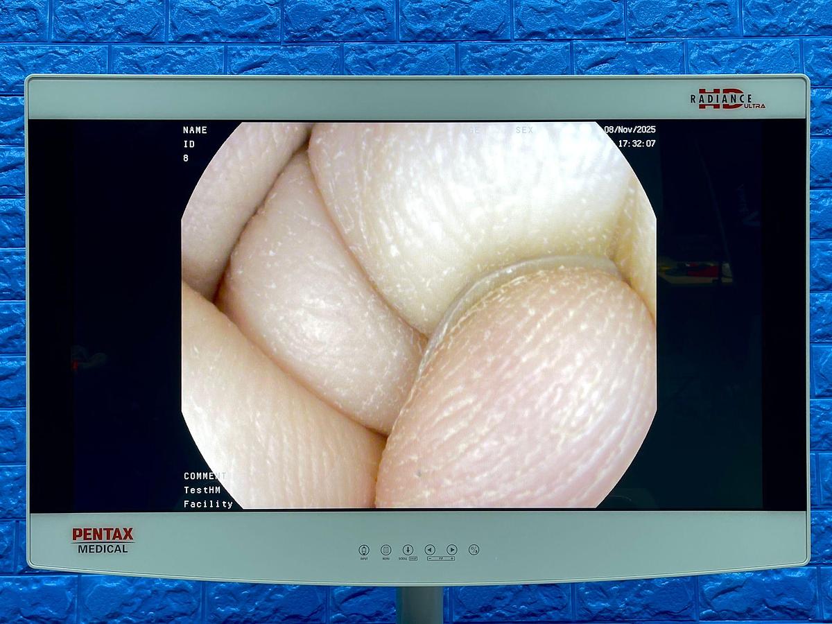 Used Pentax Scope Model: G-EYE38-i 10NL