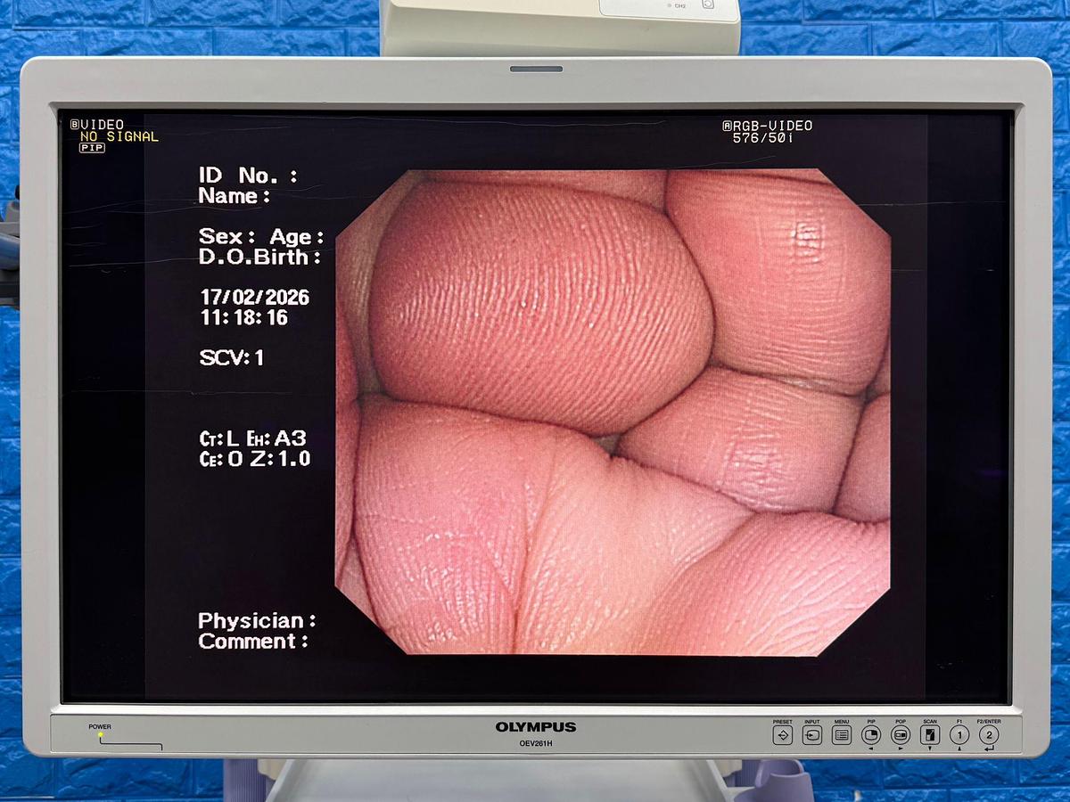 Used Olympus tower  Model : CV-260SL Scope Model : CF-H260DL HD colonoscope  Scope Model : GIF- H260 HD gastroscope  